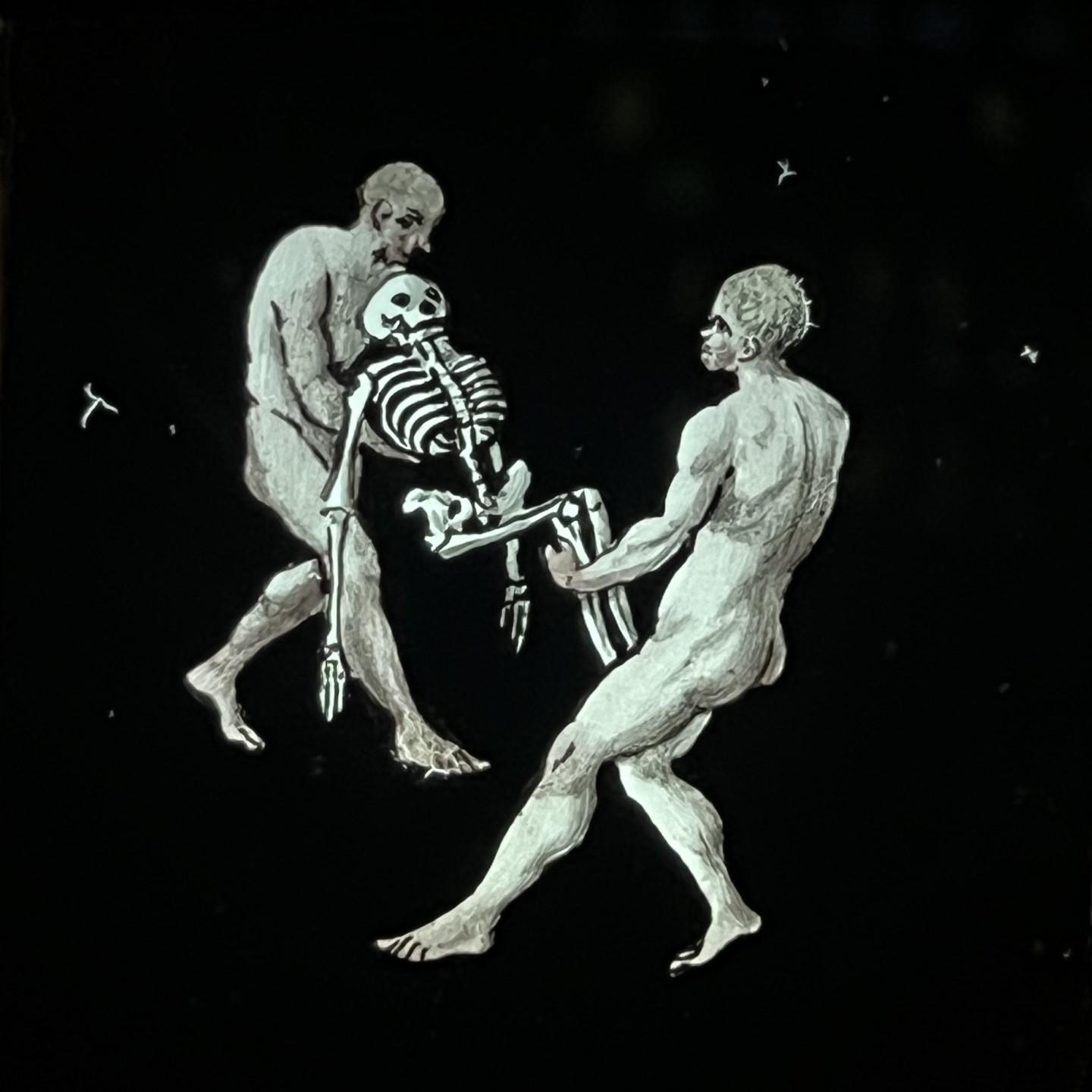 Miles J Paralysis