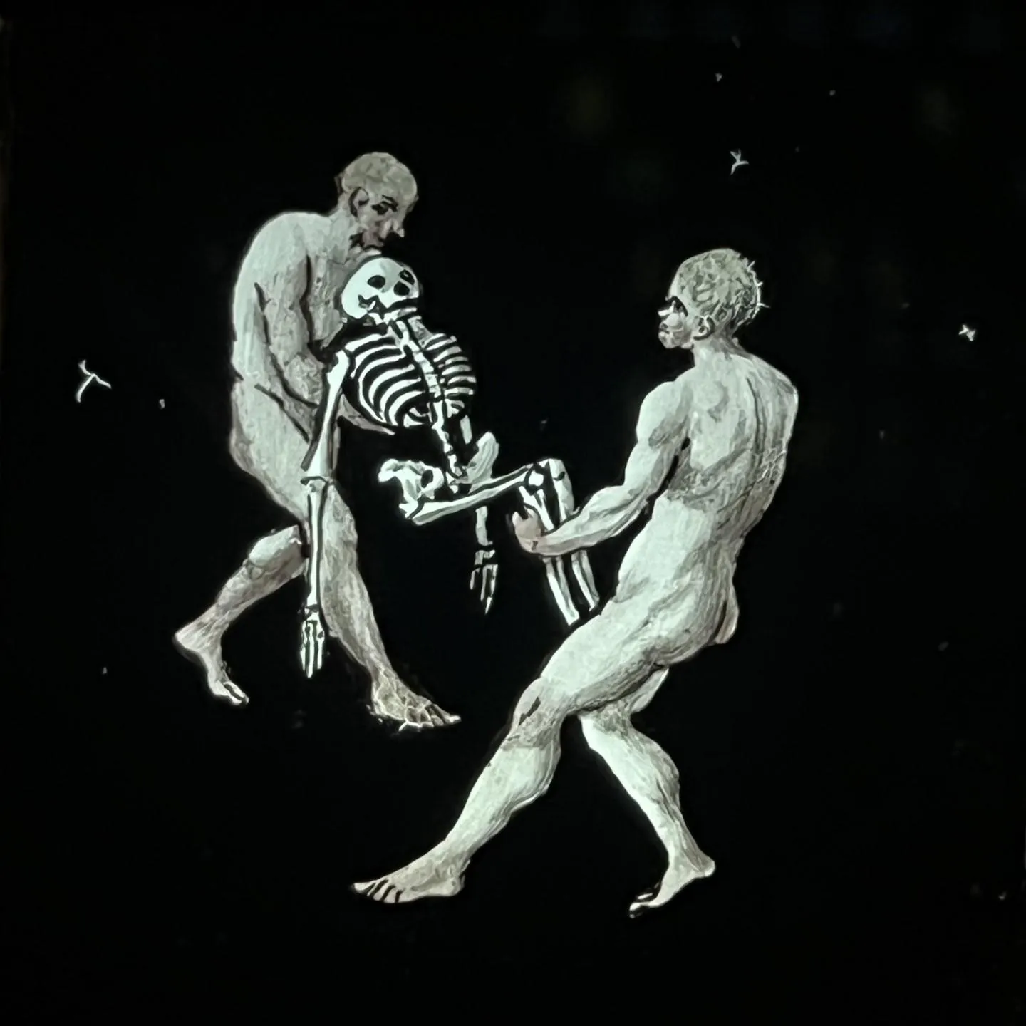 Miles J Paralysis