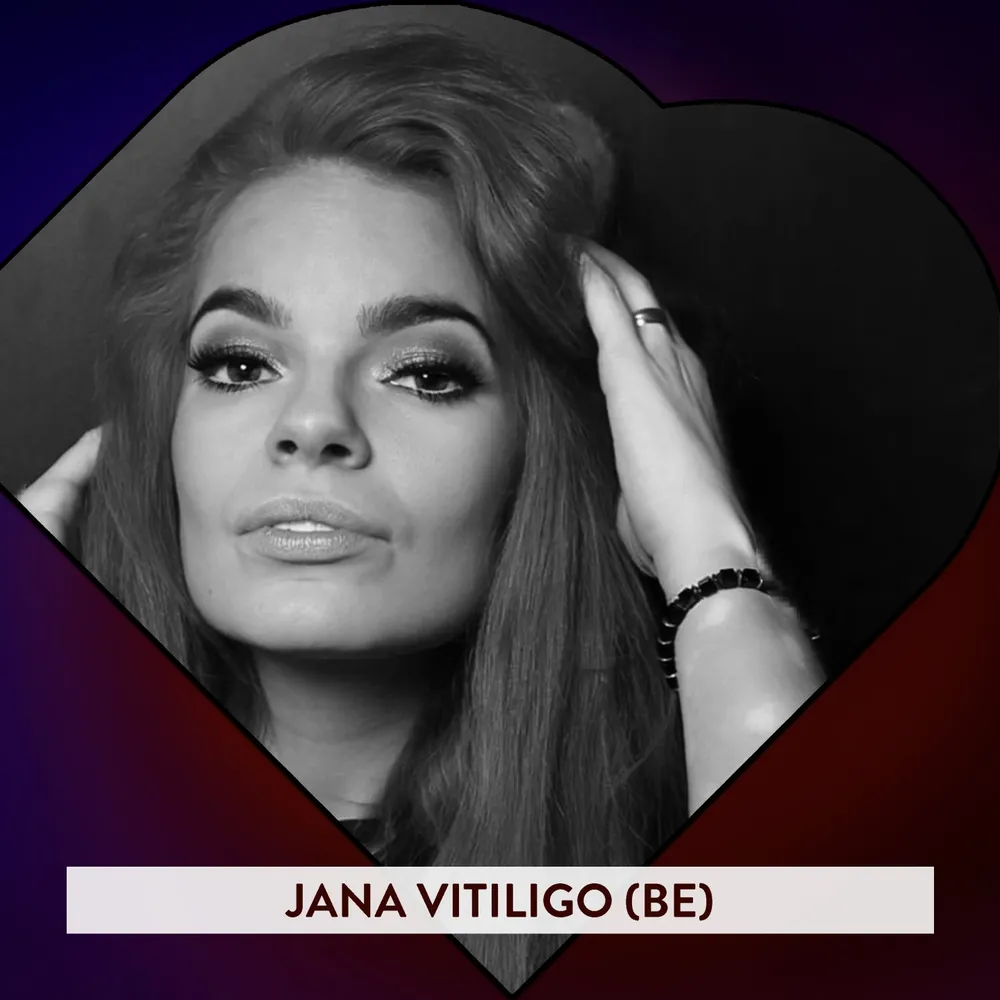 Jana Vitiligo